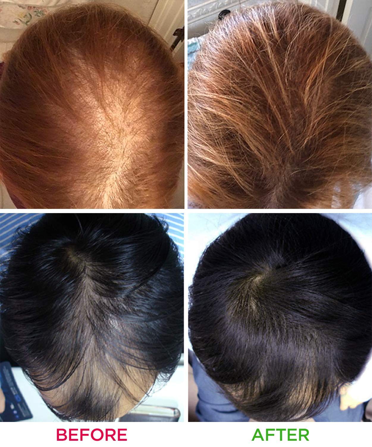 Female non surgical hair replacement before & after
